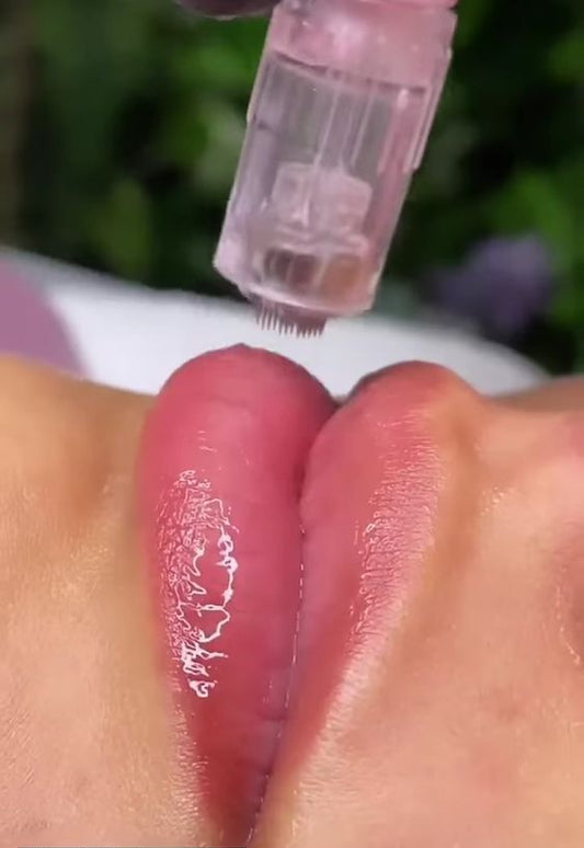 Microagujas: Hidratación de labios